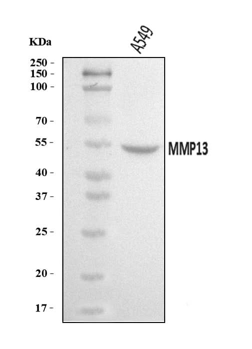 Anti-MMP13 Antibody Picoband® Boster Bio