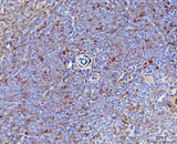 Anti-IL-17A/Il17a Antibody Boster Bio