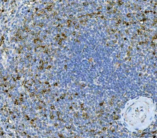 Anti-IL17A Antibody Boster Bio