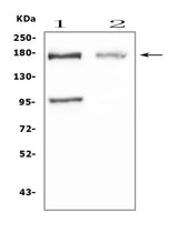 Anti-Niemann Pick C1/NPC1 Antibody Picoband® Boster Bio