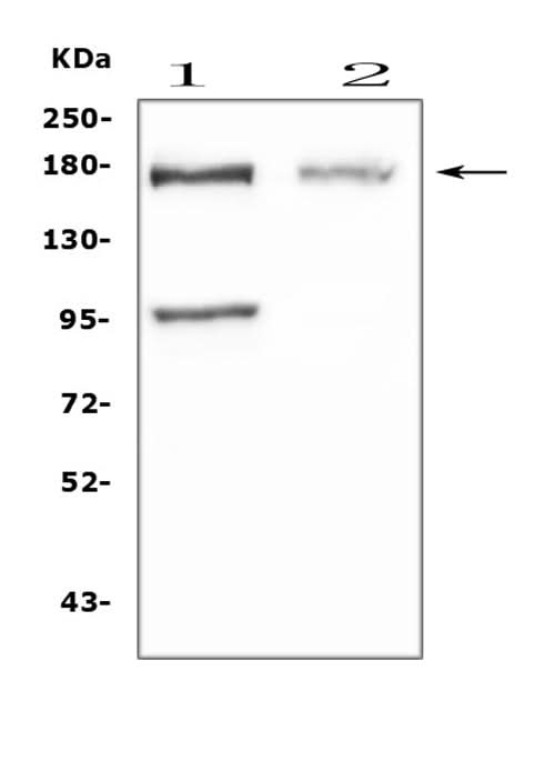 Anti-Niemann Pick C1/NPC1 Antibody Picoband® Boster Bio