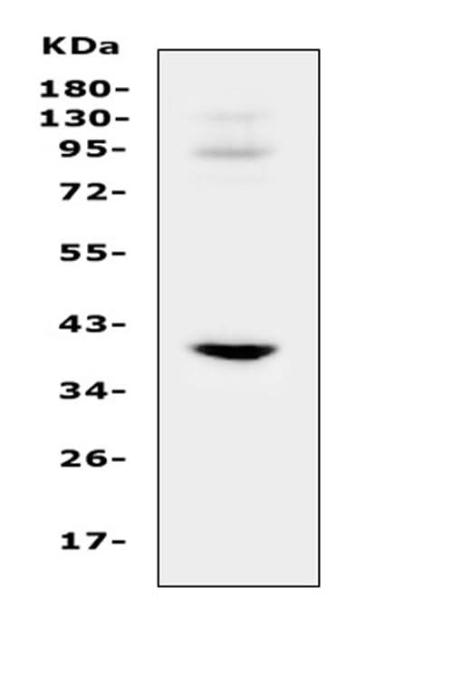 Anti-IGFBP3 Antibody Picoband® Boster Bio