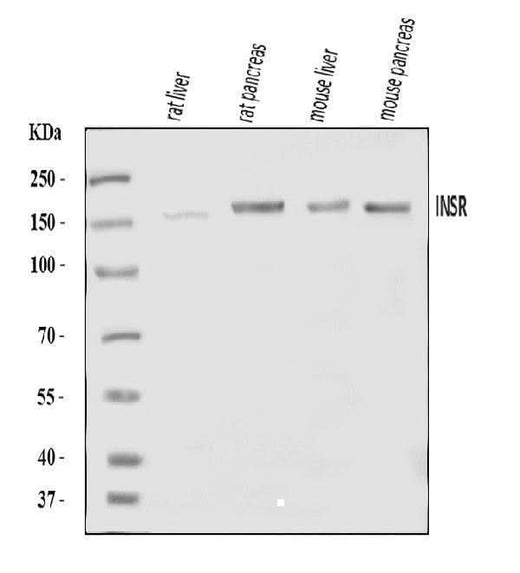 Anti-Insulin Receptor/INSR Antibody Picoband® Boster Bio