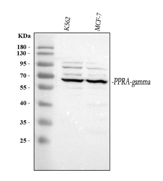 Anti-PPAR gamma/PPARG Antibody Picoband® Boster Bio