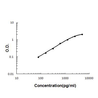 Anti-Lipocalin 2/LCN2 Antibody Boster Bio