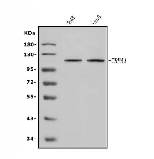 Anti-TRPA1/TSA Antibody Picoband® Boster Bio