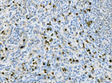 Anti-CXCR2 Antibody Boster Bio