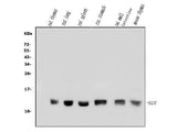 Anti-beta 2 Microglobulin/B2m Antibody Picoband® Boster Bio