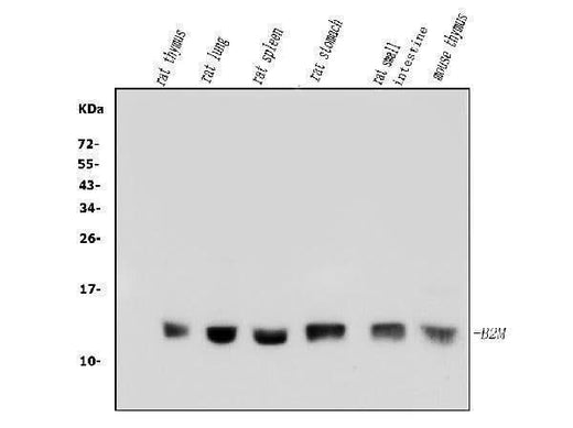 Anti-beta 2 Microglobulin/B2m Antibody Picoband® Boster Bio