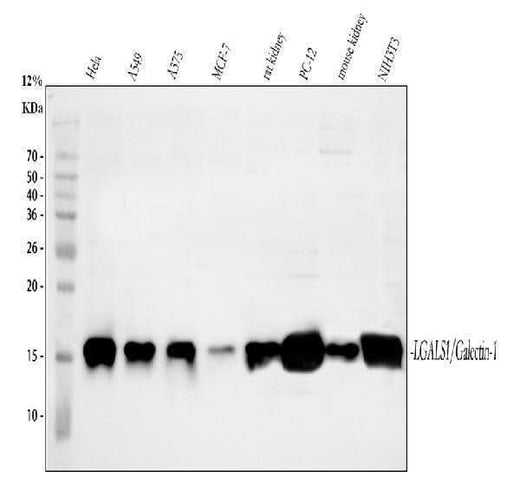 Anti-Galectin 1/Lgals1 Antibody Picoband® Boster Bio