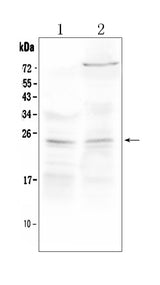 Anti-TIMP3 Antibody Picoband® Boster Bio