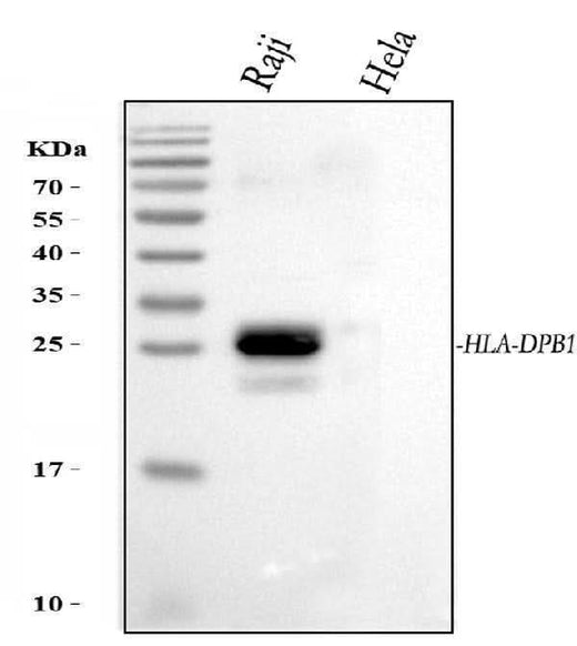 Anti-HLA-DPB1 Antibody Picoband® Boster Bio