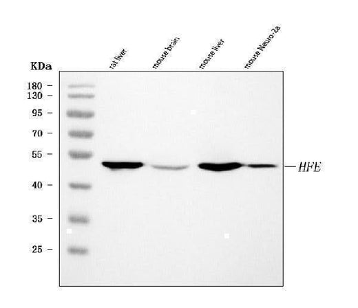 Anti-Hfe Antibody Picoband® Boster Bio