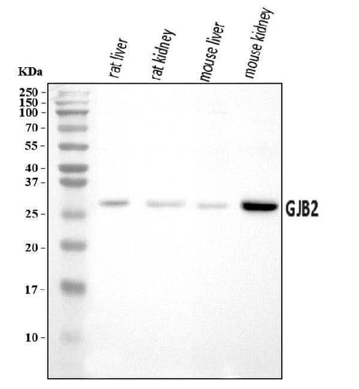 Anti-GJB2 Antibody Picoband® Boster Bio