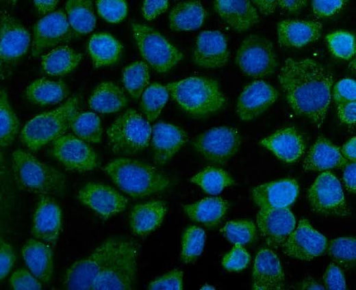 Anti-KEAP1 Antibody Picoband® Boster Bio