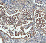 Anti-Sacsin Antibody Boster Bio