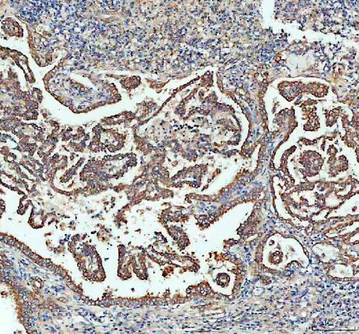 Anti-Sacsin Antibody Boster Bio