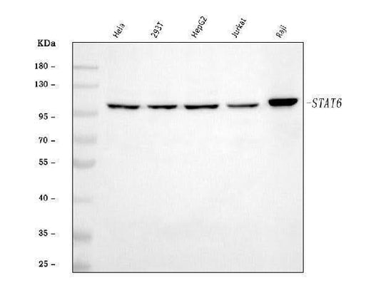 Anti-STAT6 Antibody Picoband® Boster Bio