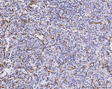 Anti-CXCL1 Antibody Boster Bio
