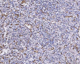 Anti-CXCL1 Antibody Boster Bio