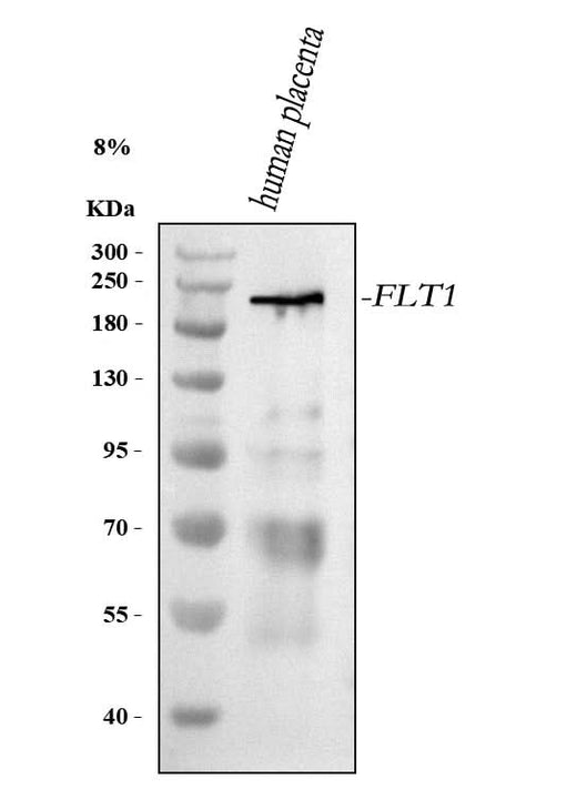 Anti-VEGFR-1/FLT1 Antibody Picoband® Boster Bio