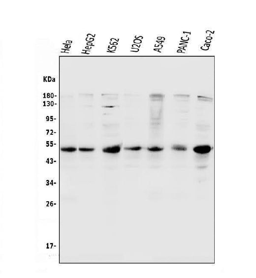 Anti-Cyclin E1/CCNE1 Antibody Picoband® Boster Bio