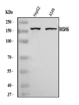 Anti-MSH6 Antibody Picoband® Boster Bio