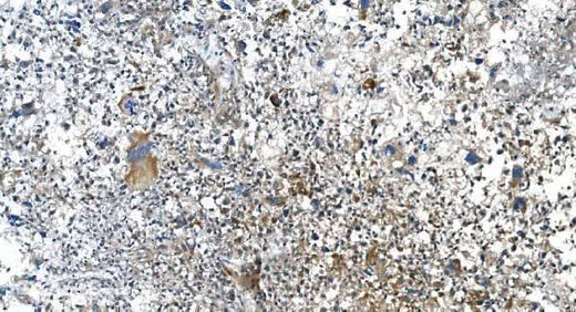 Anti-DRP1/DNM1L Antibody Picoband® Boster Bio