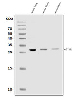 Anti-TIMP1 Antibody Picoband® Boster Bio