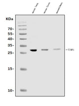 Anti-TIMP1 Antibody Picoband® Boster Bio