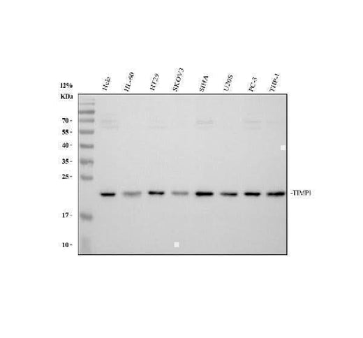 Anti-TIMP1 Antibody Picoband® Boster Bio