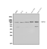 Anti-TRPV4 Antibody Picoband® Boster Bio