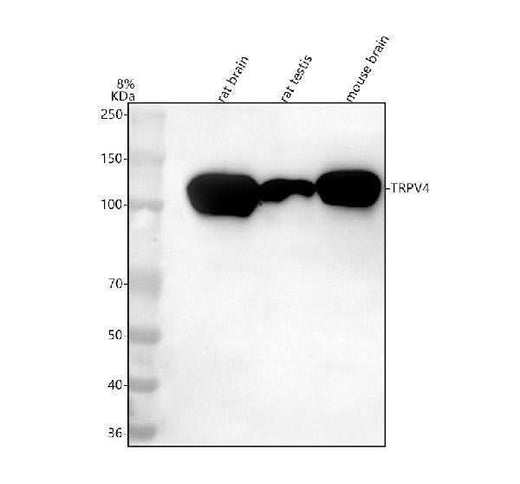 Anti-TRPV4 Antibody Picoband® Boster Bio