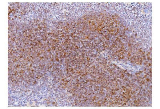 Anti-Cd2 Antibody Boster Bio