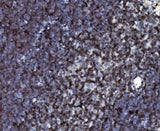 Anti-Cd2 Antibody Boster Bio