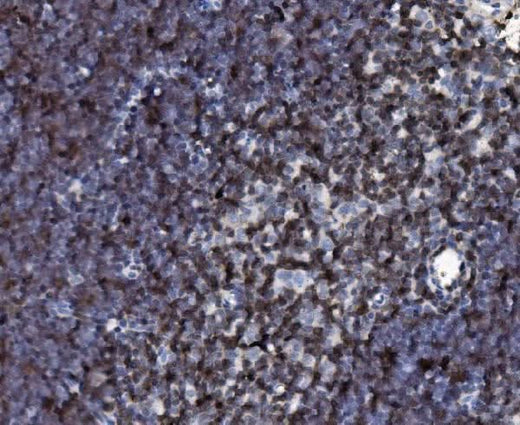 Anti-Cd2 Antibody Boster Bio