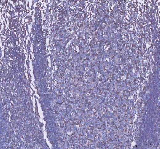 Anti-CD2 Antibody Picoband® Boster Bio