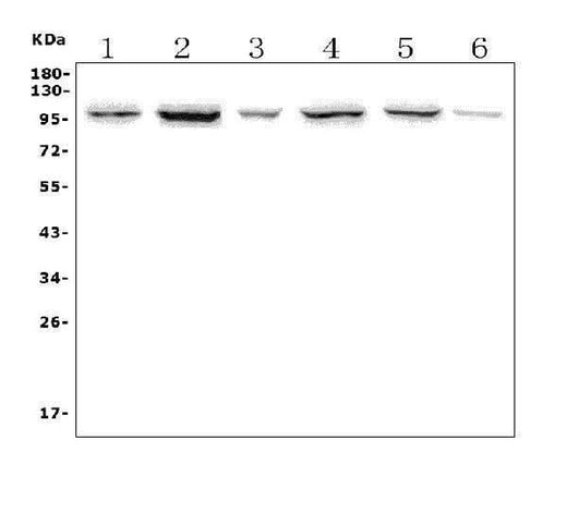Anti-PTPN22 Picoband® Antibody Boster Bio