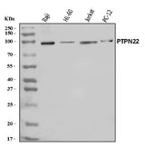 Anti-PTPN22 Antibody Picoband® Boster Bio