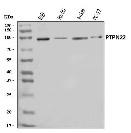 Anti-PTPN22 Antibody Picoband® Boster Bio