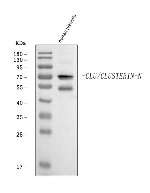 Anti-Clusterin/CLU Antibody Picoband® Boster Bio