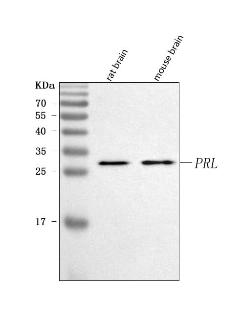 Anti-Prolactin/PRL Antibody Picoband® Boster Bio