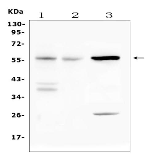 Anti-IL23 Receptor/Il23r Antibody Picoband® Boster Bio