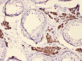 Anti-Cytochrome P450 17A1/CYP17A1 Antibody Picoband® Boster Bio