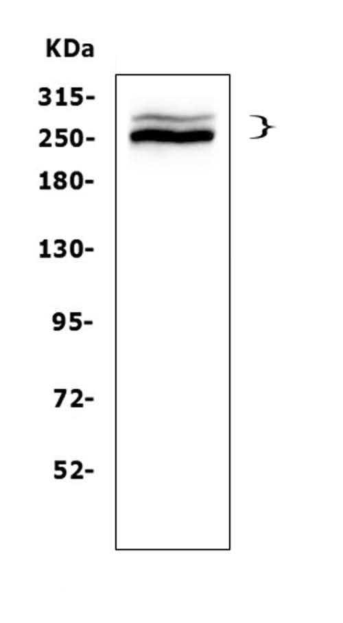 Anti-Desmoplakin/DSP Antibody Picoband® Boster Bio