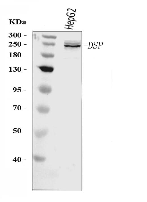 Anti-Desmoplakin/DSP Antibody Picoband® Boster Bio