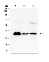 Anti-MR1 Antibody Picoband® Boster Bio