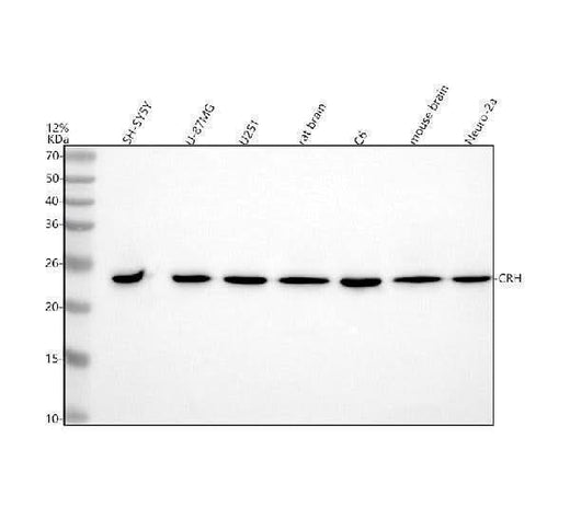Anti-CRF/CRH Antibody Picoband® Boster Bio