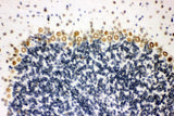 Anti-Sumo 1/SUMO1 Antibody Boster Bio