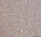 Anti-Dkk1 Antibody Boster Bio